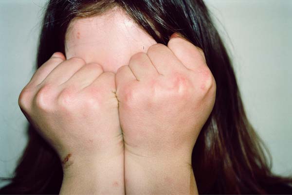 γυναίκα κρύβει το πρόσωπό της με τις δροθιές της
