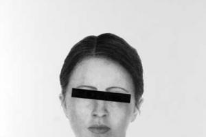 ασπρόμαυρο πορτραίτο γυναίκας με μαύρη ταινία στα μάτια